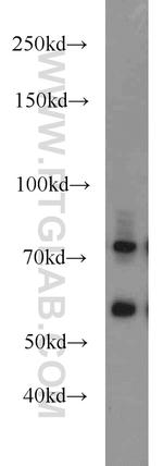 MMP2 Antibody in Western Blot (WB)