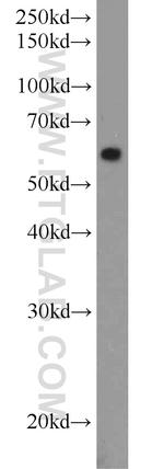 MMP2 Antibody in Western Blot (WB)