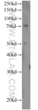 MMP2 Antibody in Western Blot (WB)