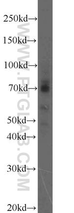 MMP2 Antibody in Western Blot (WB)