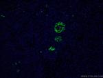 MMP7 Antibody in Immunohistochemistry (PFA fixed) (IHC (PFA))