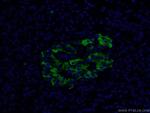 MMP7 Antibody in Immunohistochemistry (PFA fixed) (IHC (PFA))