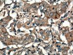 MMP7 Antibody in Immunohistochemistry (Paraffin) (IHC (P))