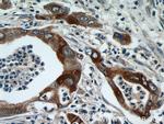 MMP7 Antibody in Immunohistochemistry (Paraffin) (IHC (P))