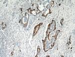 MMP7 Antibody in Immunohistochemistry (Paraffin) (IHC (P))