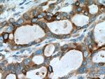 MMP7 Antibody in Immunohistochemistry (Paraffin) (IHC (P))