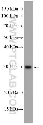 MMP7 Antibody in Western Blot (WB)