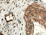 MMP9 (N-terminal) Antibody in Immunohistochemistry (Paraffin) (IHC (P))