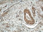 MMP9 (N-terminal) Antibody in Immunohistochemistry (Paraffin) (IHC (P))