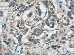 MMP9 (N-terminal) Antibody in Immunohistochemistry (Paraffin) (IHC (P))