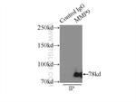 MMP9 (N-terminal) Antibody in Immunoprecipitation (IP)