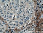 MMP9 (N-terminal) Antibody in Immunohistochemistry (Paraffin) (IHC (P))