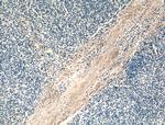 MMP9 (N-terminal) Antibody in Immunohistochemistry (Paraffin) (IHC (P))