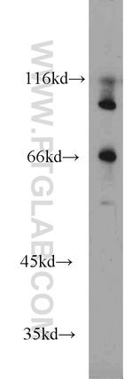 MMP9 (N-terminal) Antibody in Western Blot (WB)