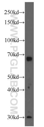 MMP9 (N-terminal) Antibody in Western Blot (WB)