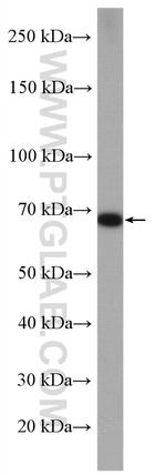 MMP9 (N-terminal) Antibody in Western Blot (WB)