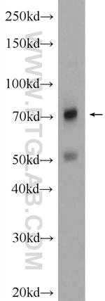 MMP9 (N-terminal) Antibody in Western Blot (WB)