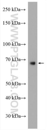 MMP9 (N-terminal) Antibody in Western Blot (WB)