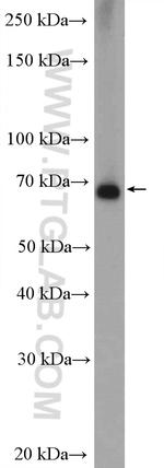 MMP9 (N-terminal) Antibody in Western Blot (WB)