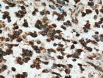 RAP1GDS1 Antibody in Immunohistochemistry (Paraffin) (IHC (P))