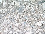 SNRPD3 Antibody in Immunohistochemistry (Paraffin) (IHC (P))