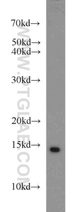 SNRPD3 Antibody in Western Blot (WB)