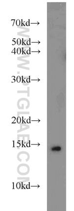 SNRPD3 Antibody in Western Blot (WB)