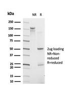 Interferon regulatory factor 9/IRF-9 Antibody in Immunoelectrophoresis (IE)