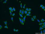 TTK Antibody in Immunocytochemistry (ICC/IF)