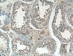 TTK Antibody in Immunohistochemistry (Paraffin) (IHC (P))