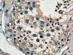 TTK Antibody in Immunohistochemistry (Paraffin) (IHC (P))