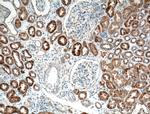 TTK Antibody in Immunohistochemistry (Paraffin) (IHC (P))