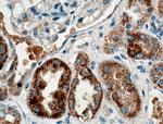 TTK Antibody in Immunohistochemistry (Paraffin) (IHC (P))