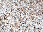 TTK Antibody in Immunohistochemistry (Paraffin) (IHC (P))