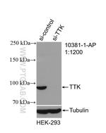 TTK Antibody in Western Blot (WB)