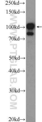 TTK Antibody in Western Blot (WB)