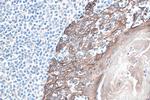 Cytokeratin 8 Antibody in Immunohistochemistry (Paraffin) (IHC (P))