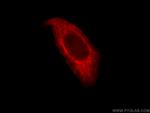 Cytokeratin 8 Antibody in Immunocytochemistry (ICC/IF)