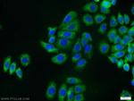 Cytokeratin 8 Antibody in Immunocytochemistry (ICC/IF)