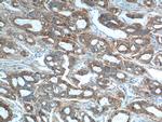 Cytokeratin 8 Antibody in Immunohistochemistry (Paraffin) (IHC (P))