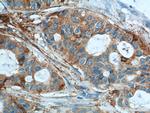 Cytokeratin 8 Antibody in Immunohistochemistry (Paraffin) (IHC (P))