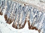 Cytokeratin 8 Antibody in Immunohistochemistry (Paraffin) (IHC (P))