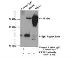Cytokeratin 8 Antibody in Immunoprecipitation (IP)