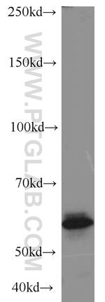 Cytokeratin 8 Antibody in Western Blot (WB)