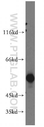 Cytokeratin 8 Antibody in Western Blot (WB)