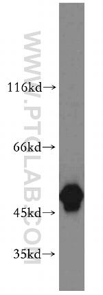 Cytokeratin 8 Antibody in Western Blot (WB)