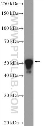 Cytokeratin 8 Antibody in Western Blot (WB)