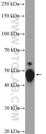 Cytokeratin 8 Antibody in Western Blot (WB)