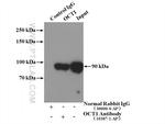 OCT1 Antibody in Immunoprecipitation (IP)