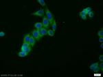 HGS Antibody in Immunocytochemistry (ICC/IF)